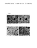 Method and Pharmaceutical Composition for Treatment of Intestinal Disease diagram and image