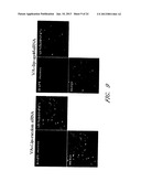 DRUG CARRIER AND DRUG CARRIER KIT FOR INHIBITING FIBROSIS diagram and image