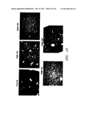 DRUG CARRIER AND DRUG CARRIER KIT FOR INHIBITING FIBROSIS diagram and image