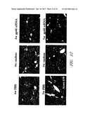 DRUG CARRIER AND DRUG CARRIER KIT FOR INHIBITING FIBROSIS diagram and image