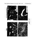 DRUG CARRIER AND DRUG CARRIER KIT FOR INHIBITING FIBROSIS diagram and image