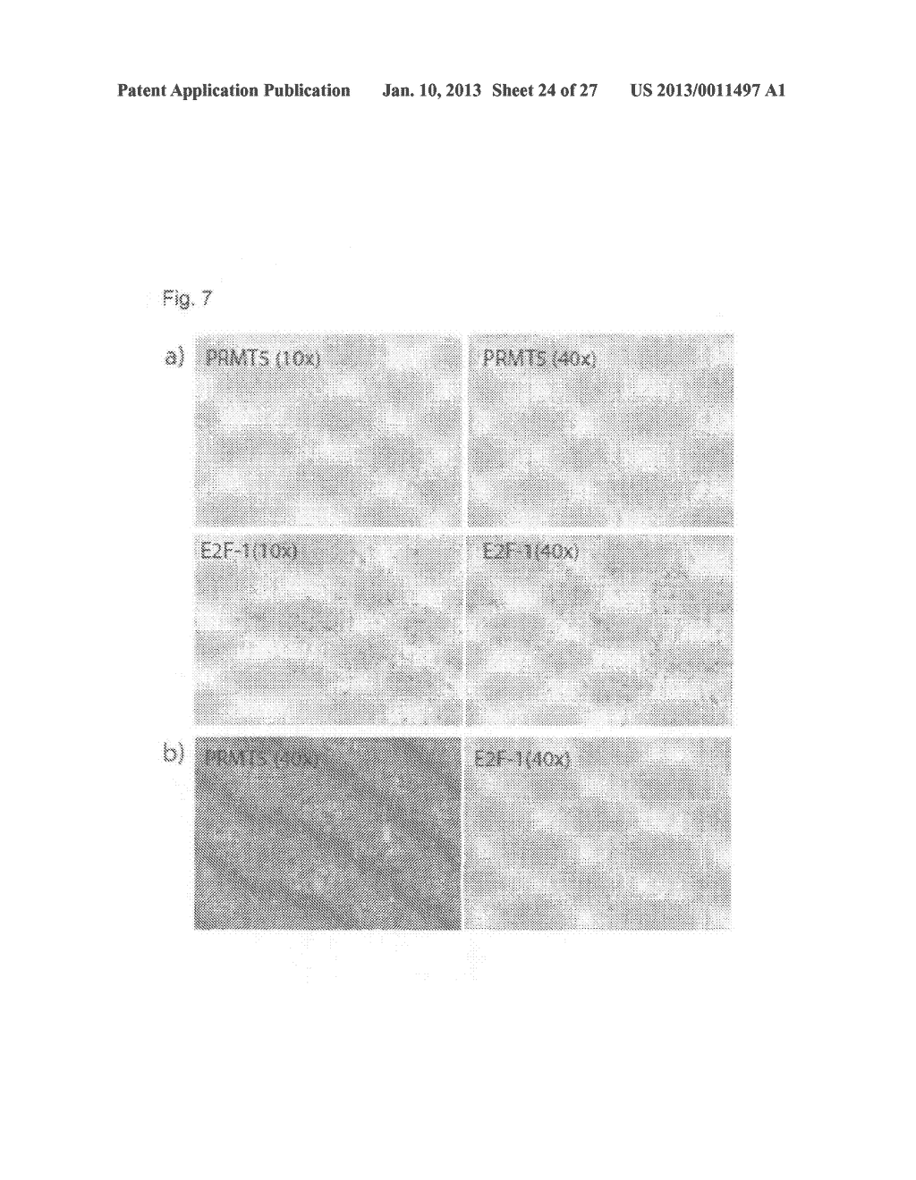 METHOD OF TREATMENT AND SCREENING METHOD - diagram, schematic, and image 25