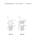 DENTAL IMPLANT DEVICES, KITS, AND METHODS diagram and image