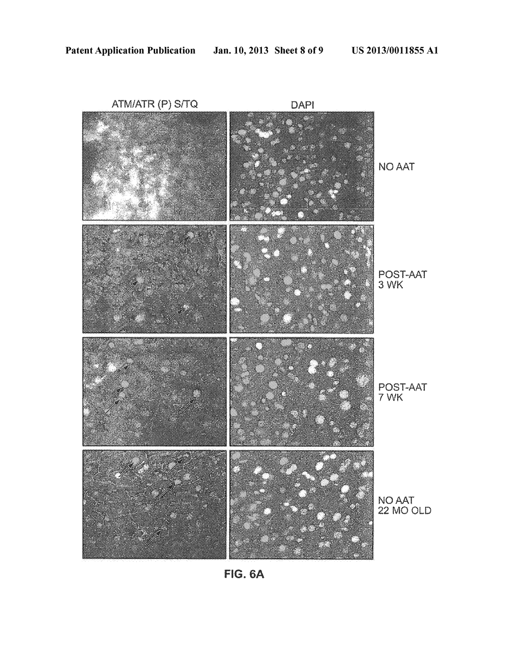 Methods for Determining Aged Based Accumulation of Senescent Cells Using     Senescense Specific DNA Damage Markers - diagram, schematic, and image 09