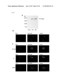 METHOD OF DIAGNOSING BLADDER CANCER diagram and image