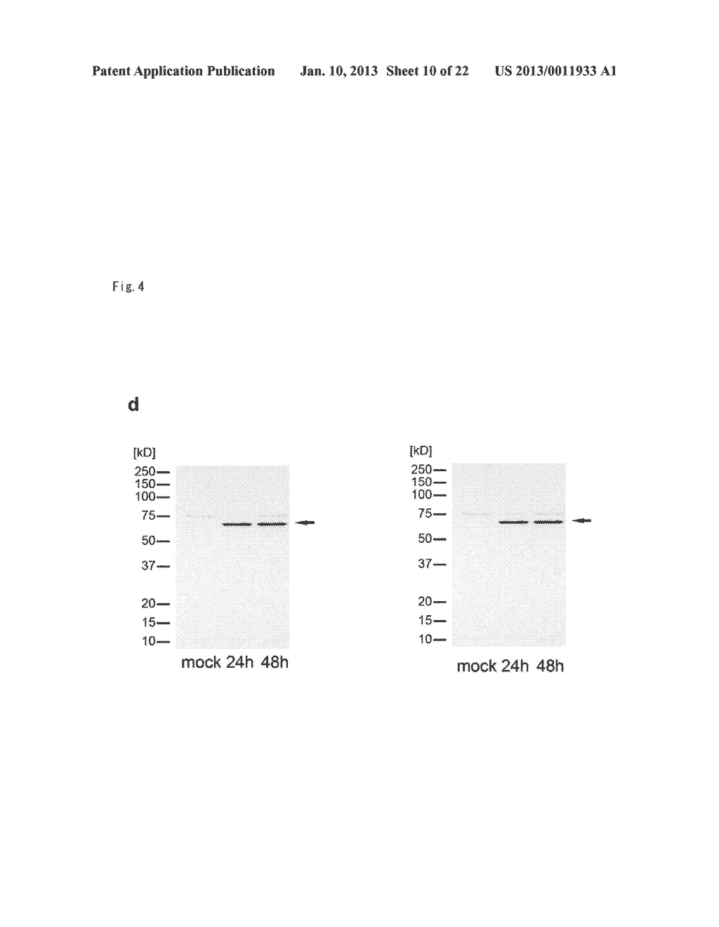 METHOD OF DIAGNOSING BLADDER CANCER - diagram, schematic, and image 11