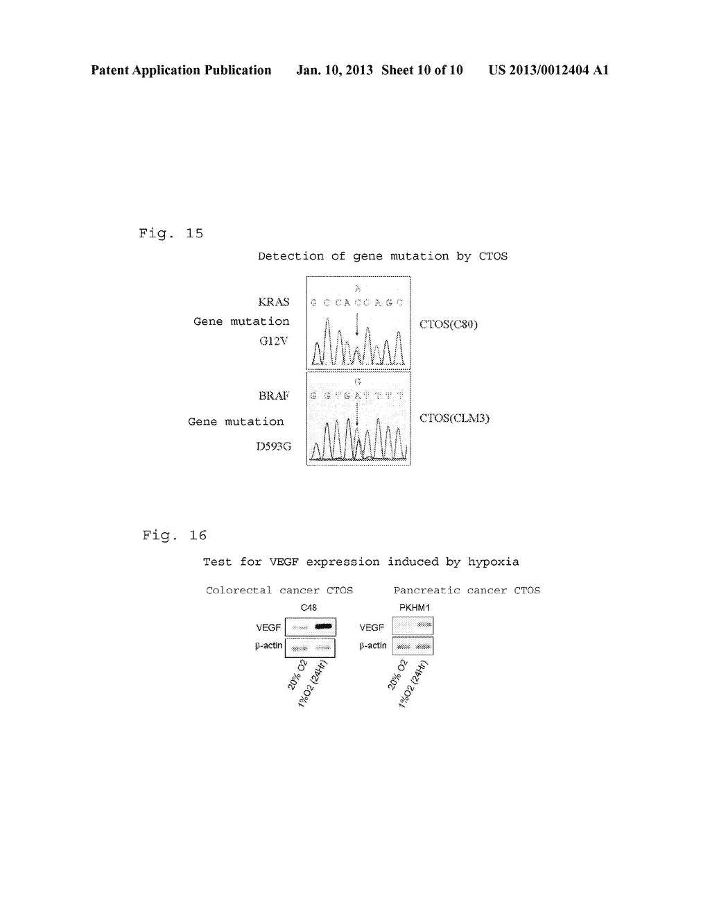 CULTURE METHOD, EVALUATION METHOD AND STORAGE METHOD FOR     CANCER-TISSUE-DERIVED CELL MASS OR AGGREGATED CANCER CELL MASS - diagram, schematic, and image 11
