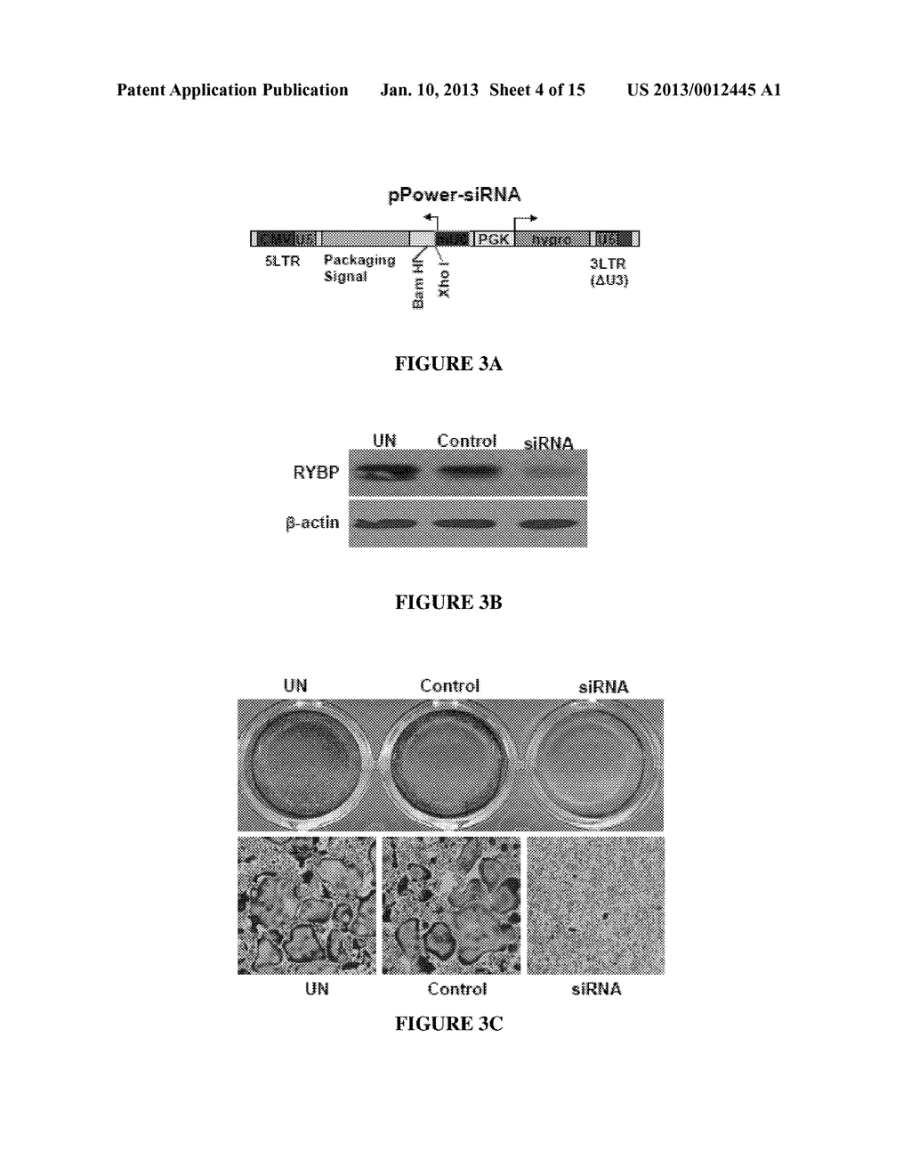 Compositions for Improving Bone Mass - diagram, schematic, and image 05