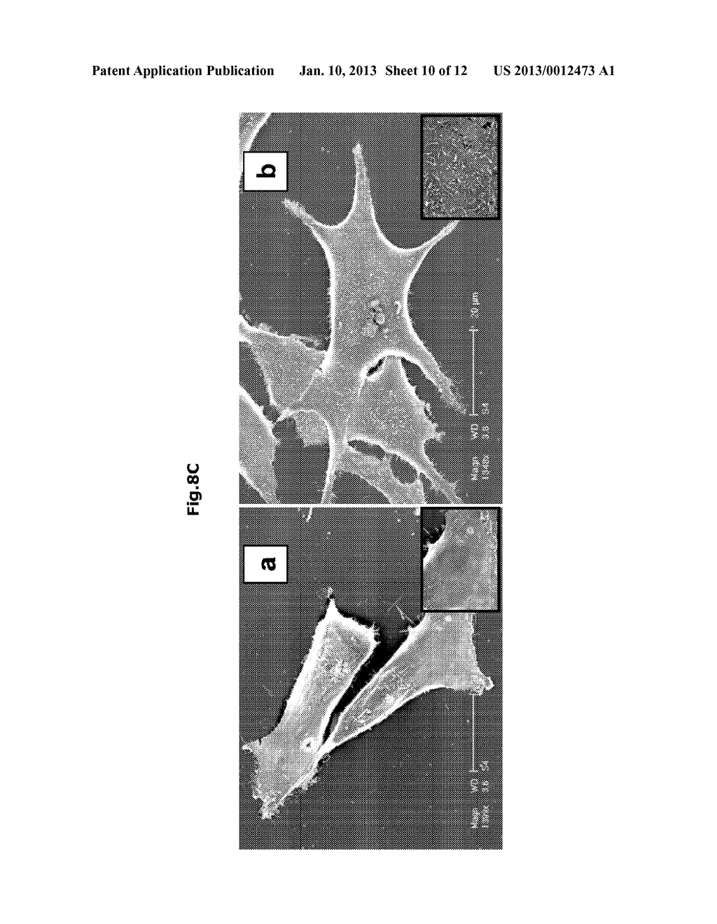 COMBINED USE OF PHOSPHOLIPID AND SULFATE GROUPS-CARRYING POLYSACCHARIDES     FOR INHIBITING METASTATIC SPREAD - diagram, schematic, and image 11