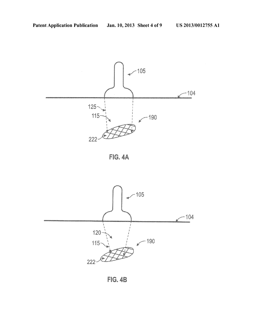 SYSTEMS AND METHODS FOR ACCELERATING HEALING OF IMPLANTED MATERIAL AND/OR     NATIVE TISSUE - diagram, schematic, and image 05