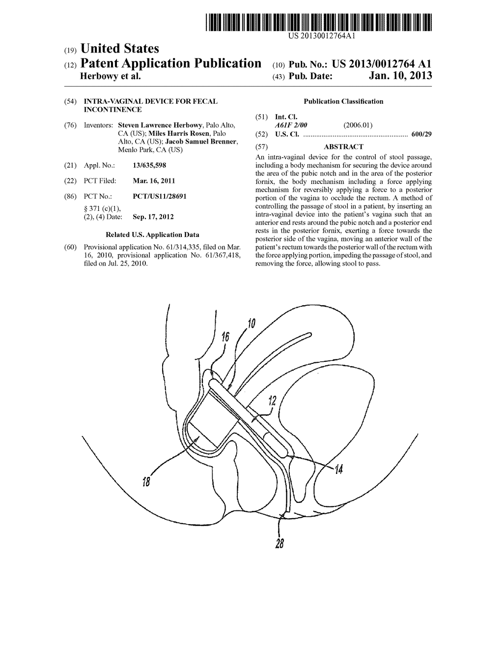 INTRA-VAGINAL DEVICE FOR FECAL INCONTINENCE - diagram, schematic, and image 01