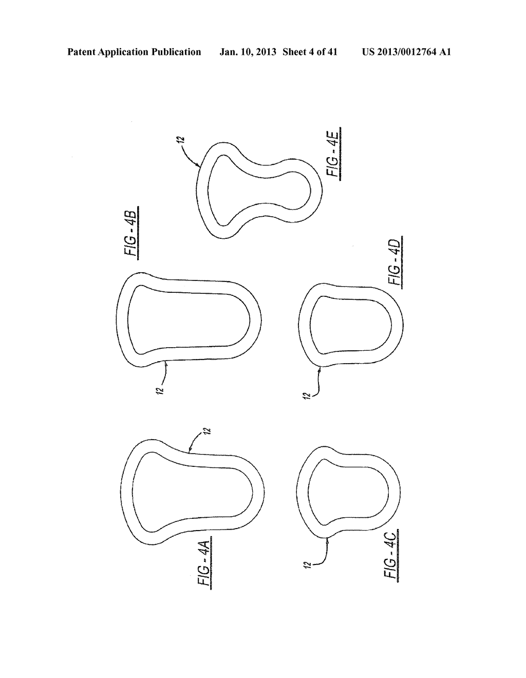 INTRA-VAGINAL DEVICE FOR FECAL INCONTINENCE - diagram, schematic, and image 05