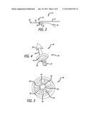 Adjustable Implant diagram and image