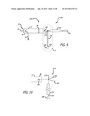 Adjustable Implant diagram and image