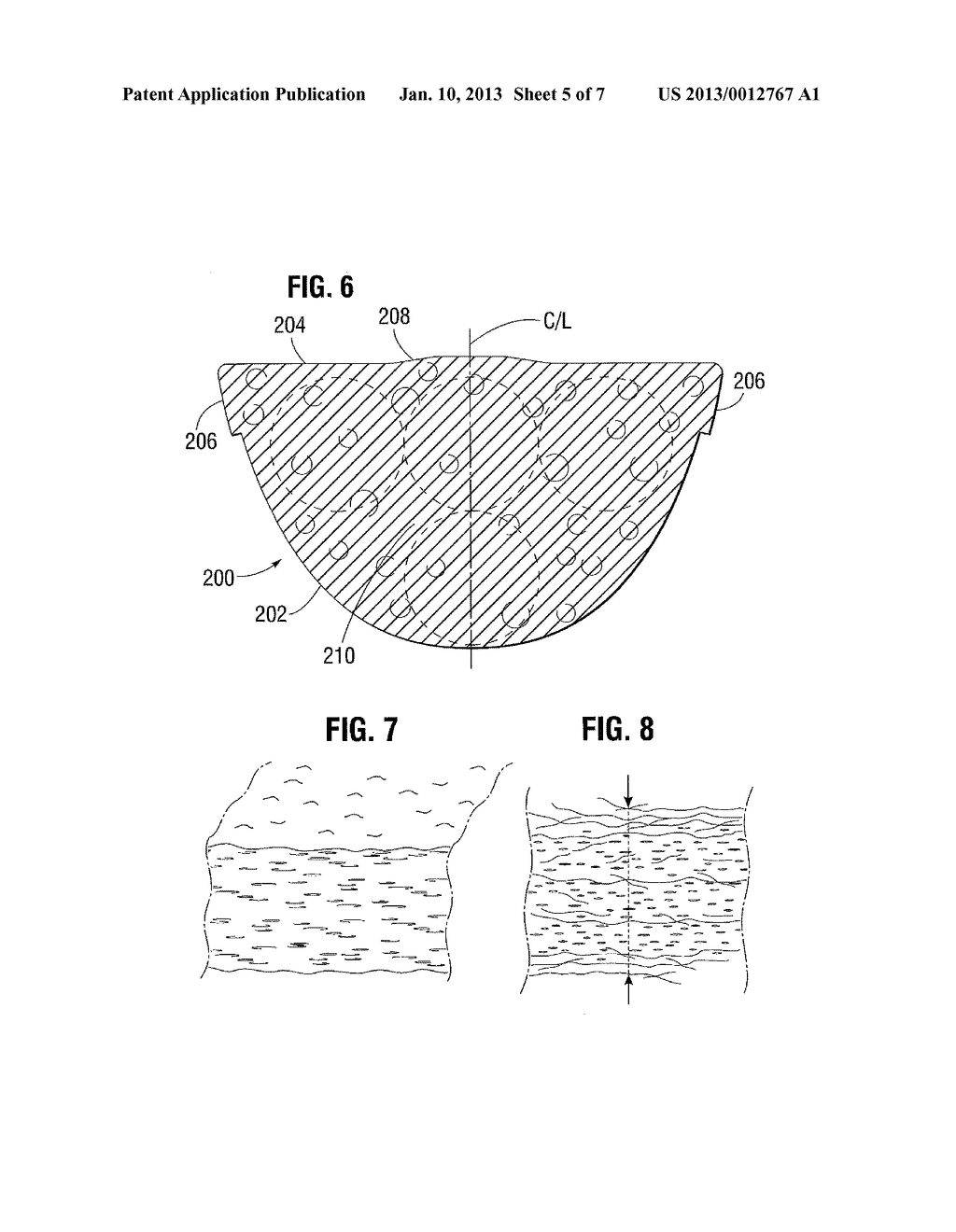 SYSTEMS, DIES, AND METHODS FOR PROCESSING PERICARDIAL TISSUE - diagram, schematic, and image 06