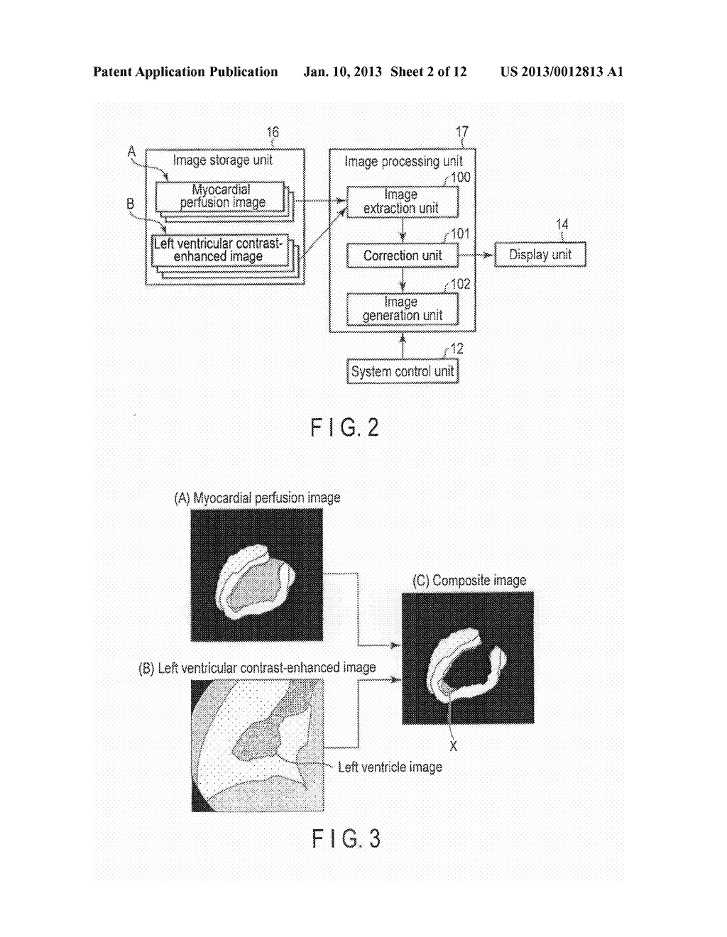 IMAGE PROCESSING APPARATUS AND X-RAY DIAGNOSTIC APPARATUS - diagram, schematic, and image 03