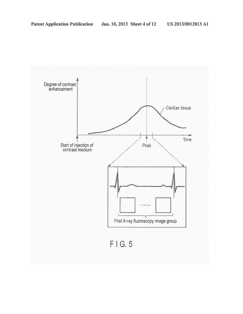 IMAGE PROCESSING APPARATUS AND X-RAY DIAGNOSTIC APPARATUS - diagram, schematic, and image 05