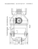 Robotic module for natural orifice transluminal endoscopic surgery (NOTES) diagram and image