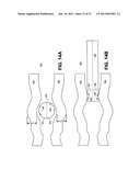 METHOD, SYSTEM AND APPARATUS FOR NEURAL LOCALIZATION diagram and image