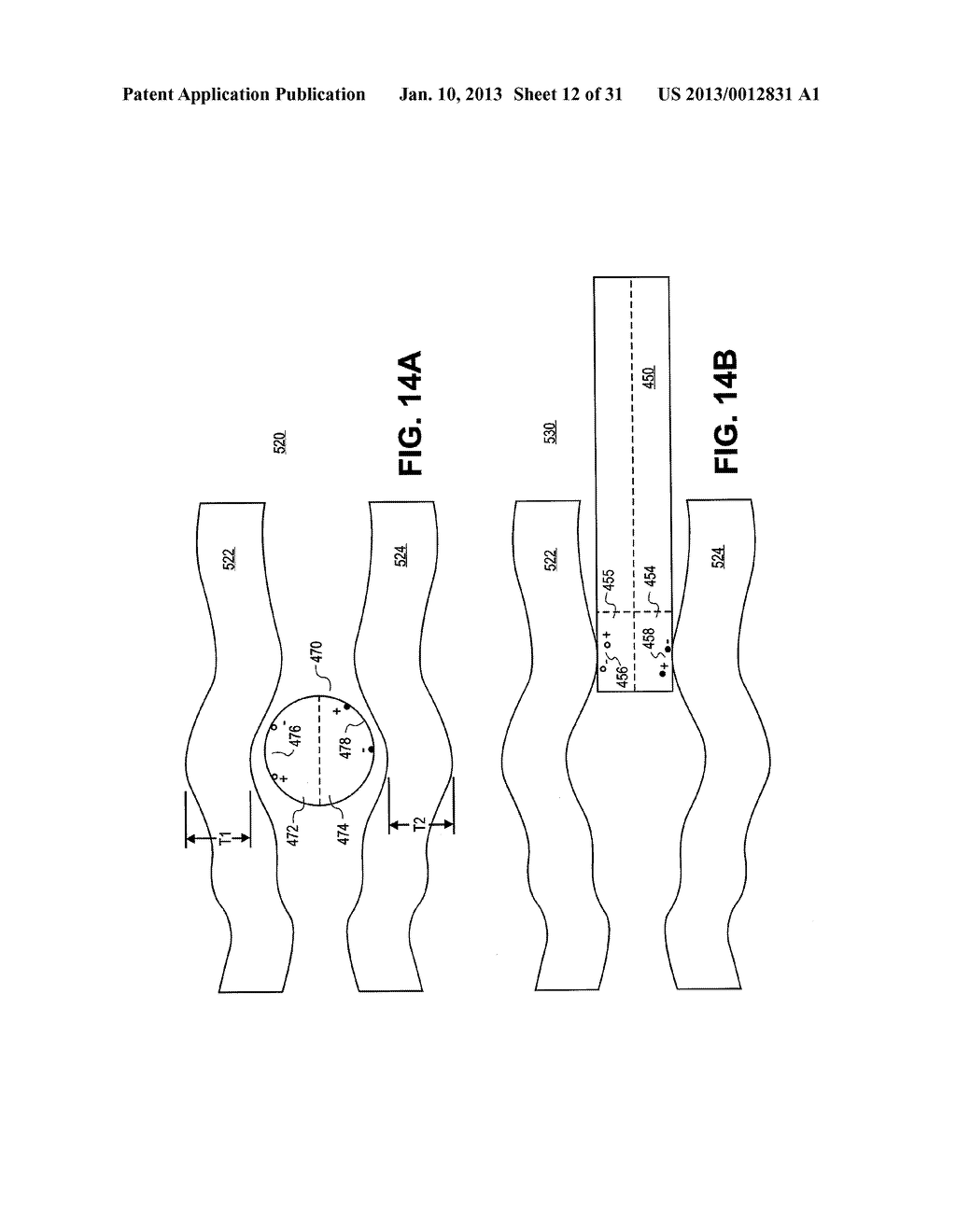 METHOD, SYSTEM AND APPARATUS FOR NEURAL LOCALIZATION - diagram, schematic, and image 13