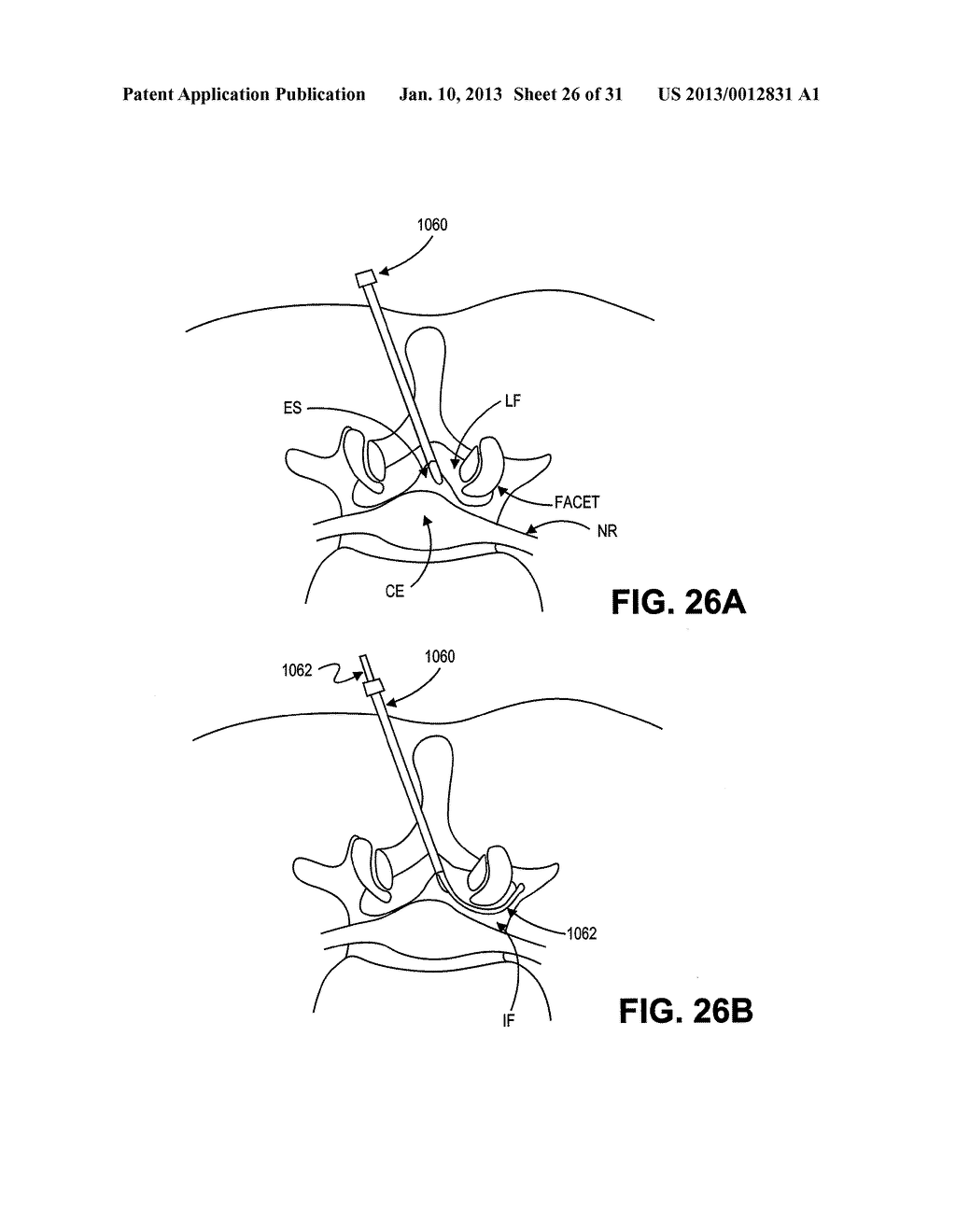 METHOD, SYSTEM AND APPARATUS FOR NEURAL LOCALIZATION - diagram, schematic, and image 27