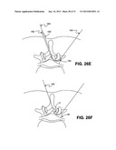 METHOD, SYSTEM AND APPARATUS FOR NEURAL LOCALIZATION diagram and image