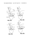 METHOD, SYSTEM AND APPARATUS FOR NEURAL LOCALIZATION diagram and image