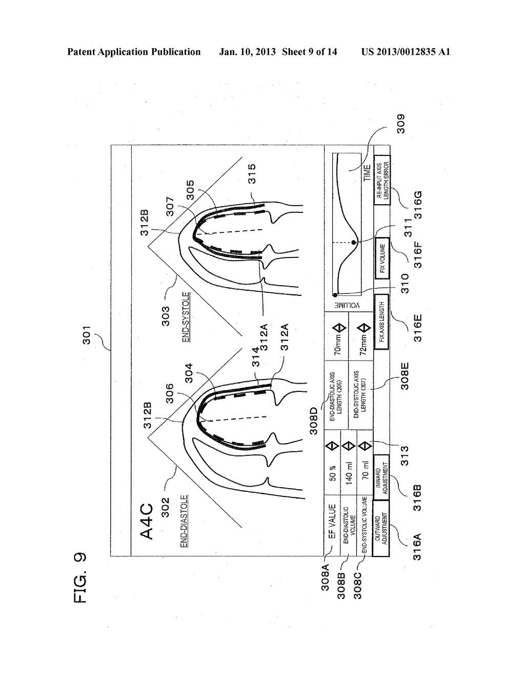 ULTRASONIC DIAGNOSTIC APPARATUS AND METHOD FOR RE-INPUTTING MEASUREMENT     VALUE OF MEDICAL IMAGE - diagram, schematic, and image 10