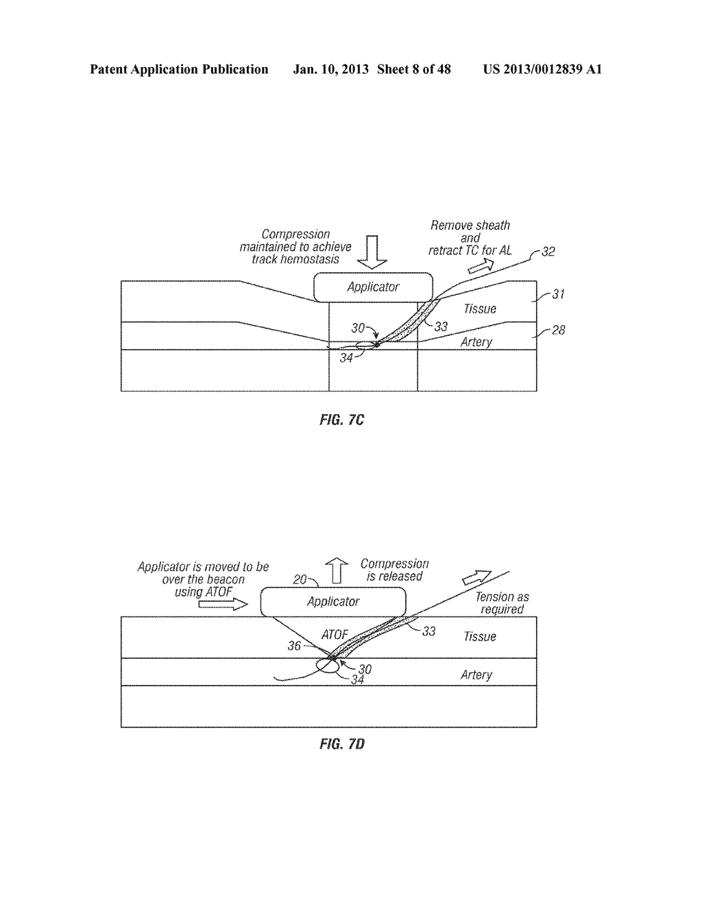 SYSTEM AND METHOD FOR TREATING A THERAPEUTIC SITE - diagram, schematic, and image 09