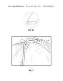 ADJUSTABLE PATIENT THERAPY DEVICE diagram and image