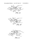 PACKAGED MEDICAL ADHESIVE COMPOSITE AND METHOD OF DELIVERING THE COMPOSITE diagram and image