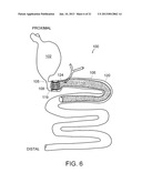 METHODS AND APPARATUS FOR ANCHORING WITHIN THE GASTROINTESTINAL TRACT diagram and image