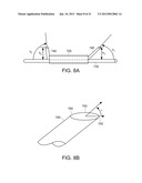 METHODS AND APPARATUS FOR ANCHORING WITHIN THE GASTROINTESTINAL TRACT diagram and image