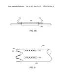 METHODS AND APPARATUS FOR ANCHORING WITHIN THE GASTROINTESTINAL TRACT diagram and image