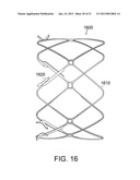 METHODS AND APPARATUS FOR ANCHORING WITHIN THE GASTROINTESTINAL TRACT diagram and image