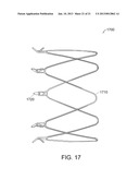 METHODS AND APPARATUS FOR ANCHORING WITHIN THE GASTROINTESTINAL TRACT diagram and image