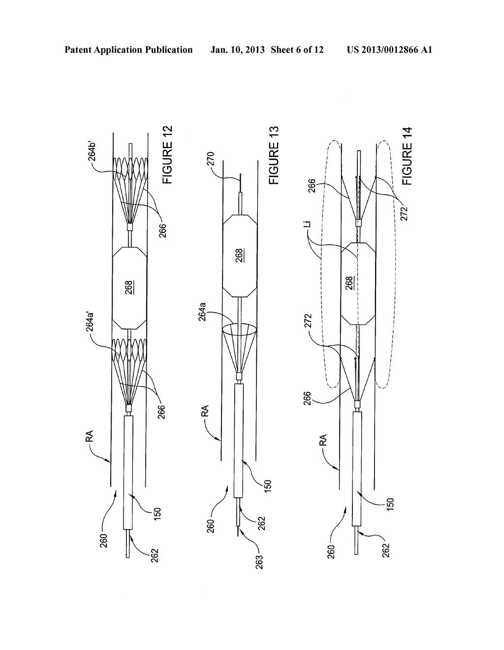 APPARATUSES FOR RENAL NEUROMODULATION AND ASSOCIATED SYSTEMS AND METHODS - diagram, schematic, and image 07