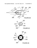 METHODS AND APPARATUS FOR PERFORMING A NON-CONTINUOUS CIRCUMFERENTIAL     TREATMENT OF A BODY LUMEN diagram and image