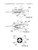 METHODS AND APPARATUS FOR PERFORMING A NON-CONTINUOUS CIRCUMFERENTIAL     TREATMENT OF A BODY LUMEN diagram and image