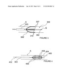 METHODS AND APPARATUS FOR PERFORMING A NON-CONTINUOUS CIRCUMFERENTIAL     TREATMENT OF A BODY LUMEN diagram and image