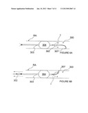 METHODS AND APPARATUS FOR PERFORMING A NON-CONTINUOUS CIRCUMFERENTIAL     TREATMENT OF A BODY LUMEN diagram and image