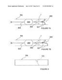 METHODS AND APPARATUS FOR PERFORMING A NON-CONTINUOUS CIRCUMFERENTIAL     TREATMENT OF A BODY LUMEN diagram and image