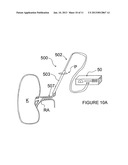 METHODS AND APPARATUS FOR PERFORMING A NON-CONTINUOUS CIRCUMFERENTIAL     TREATMENT OF A BODY LUMEN diagram and image