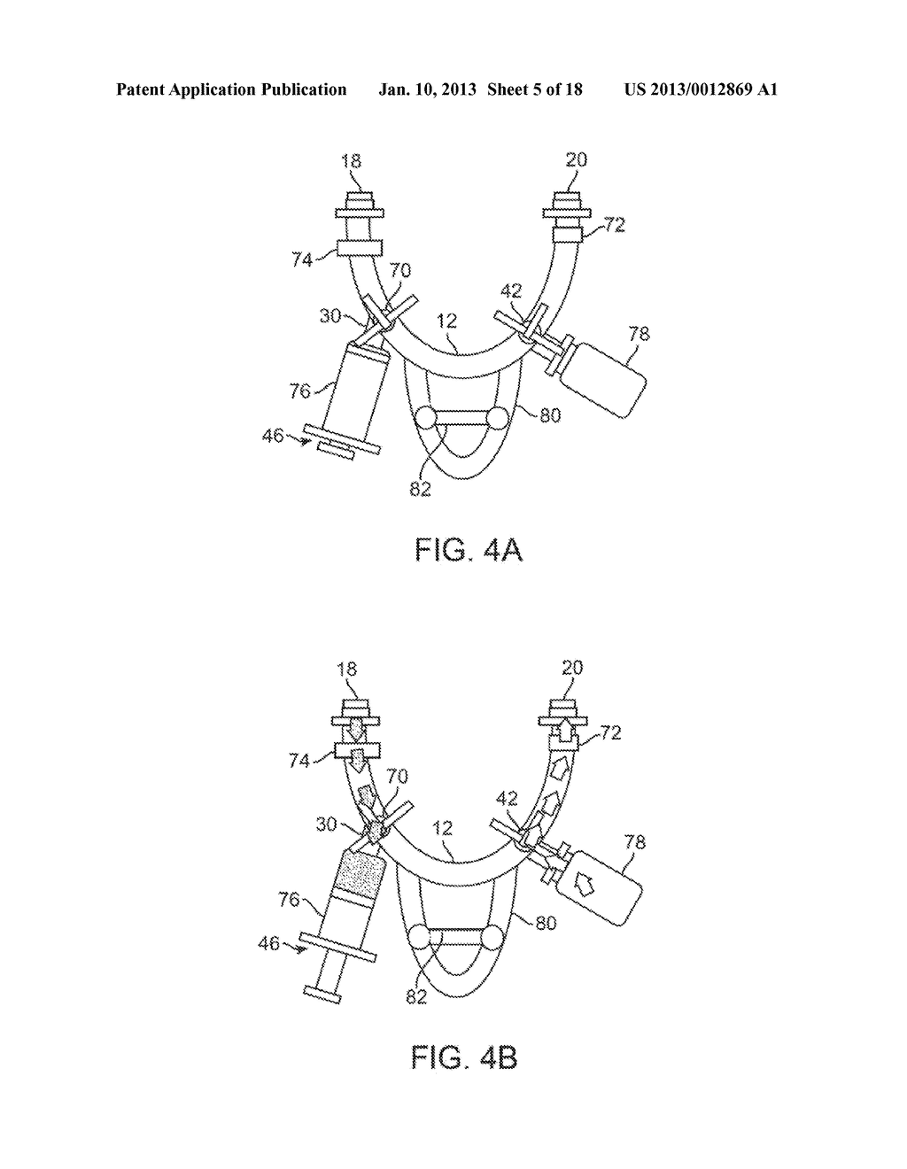 NASAL IRRIGATION SYSTEMS - diagram, schematic, and image 06