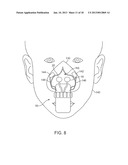 NASAL IRRIGATION SYSTEMS diagram and image