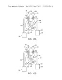 NASAL IRRIGATION SYSTEMS diagram and image