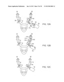 NASAL IRRIGATION SYSTEMS diagram and image