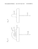 INFUSION DEVICE AND METHOD OF USING AND MAKING THE SAME diagram and image