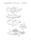 STABILIZED IMPLANTABLE VASCULAR ACCESS PORT diagram and image