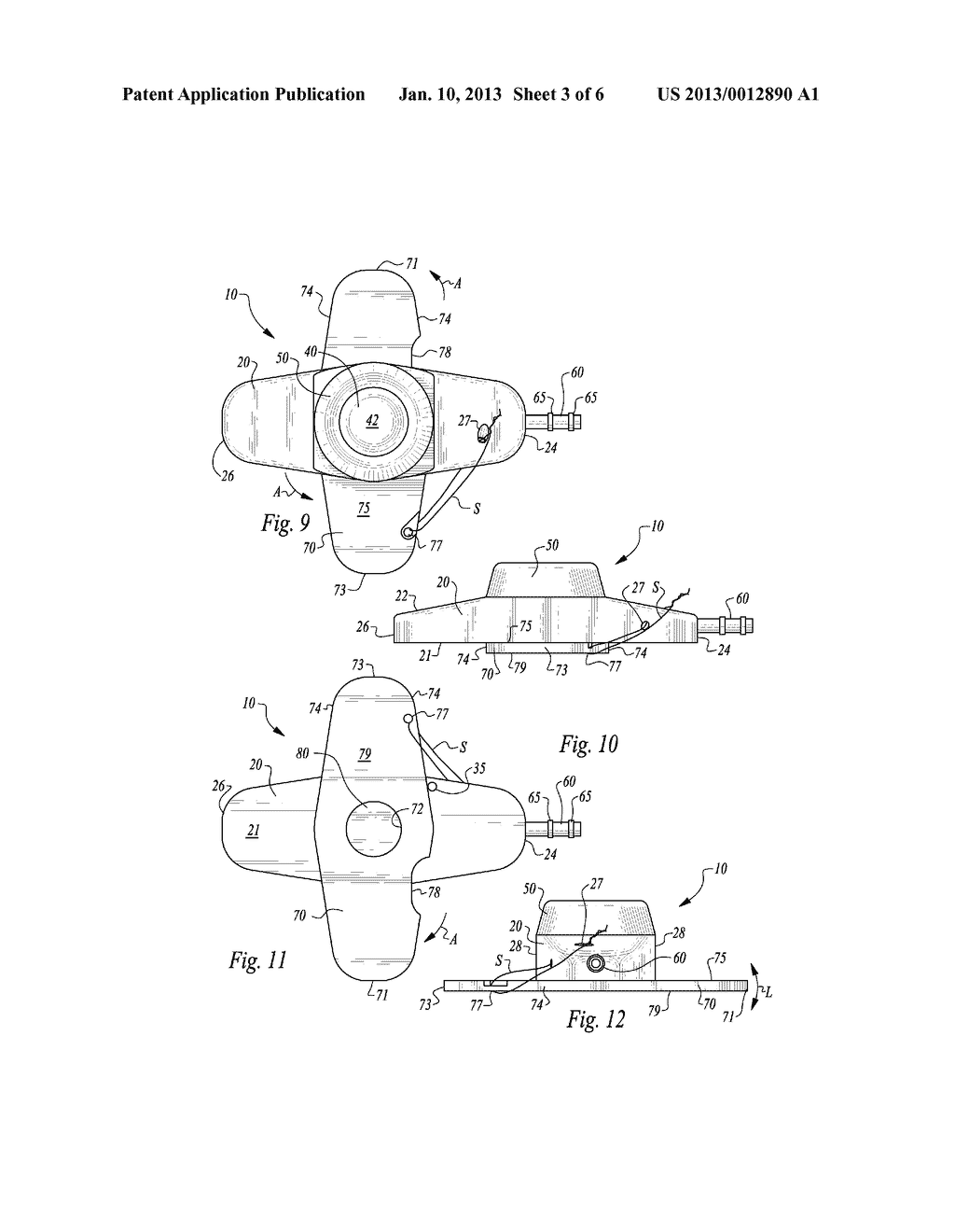 STABILIZED IMPLANTABLE VASCULAR ACCESS PORT - diagram, schematic, and image 04